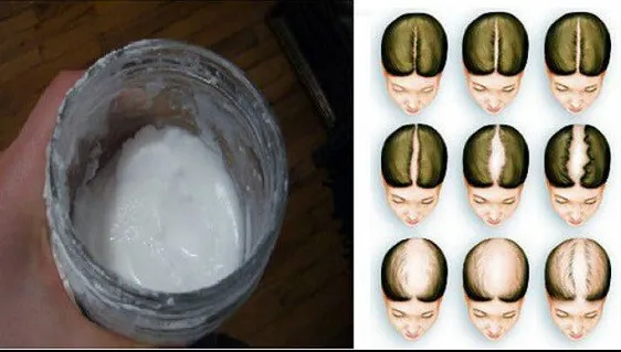 Șamponul natural care-ți face părul să crească repede, ca prin minune