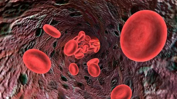 Aceasta este reţeta care îţi distruge toată grăsimea din sânge. Ai nevoie de DOUĂ ingrediente