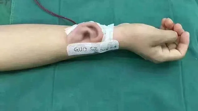 Medicii i-au lipit o ureche de mână. "Va începe din nou să audă peste 4 luni"