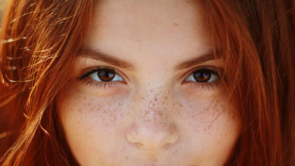 Cum scapi de pistrui. Tratamentele naturale care fac minuni - Cele mai eficiente REMEDII