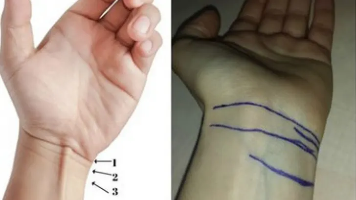 Numărul lor îți arată când vei muri. Tu câte linii ai la încheietura mâinii?