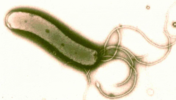 Leguma care omoară bacteria helicobacter pilori, cea care cauzează ulcerele