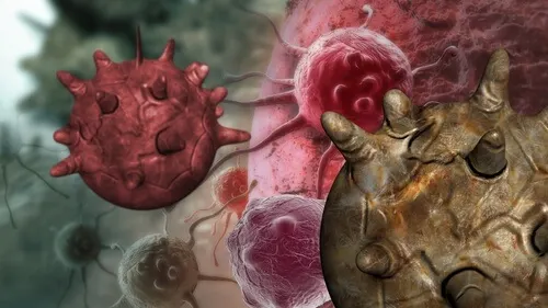 Cele mai frecvente 4 mituri despre cancer