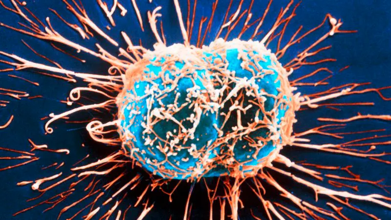 Ce declanșează apariția și răspândirea cancerului în organism? Oamenii de știință au o nouă teorie