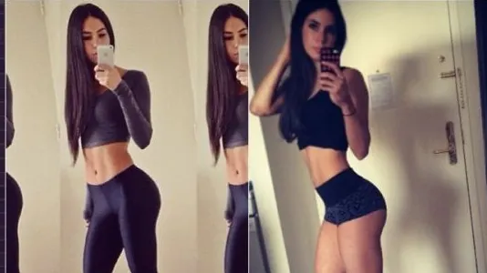 Pui astfel de poze pe Facebook? Ce boală ai putea să ai