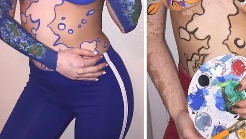 Și-a transformat trupul într-o operă de artă după ce au râs de ea pentru că suferă de vitiligo
