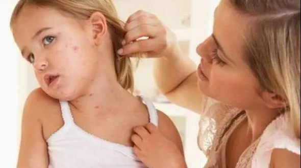 Avertisment: epidemia de rujeolă din România riscă să se extindă în Europa