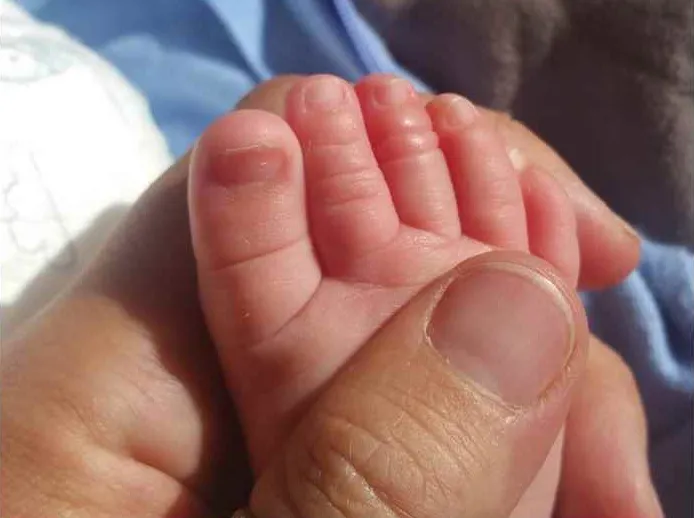 De ce trebuie să priveşti atent piciorul bebeluşului. Medicii NU îţi spun asta