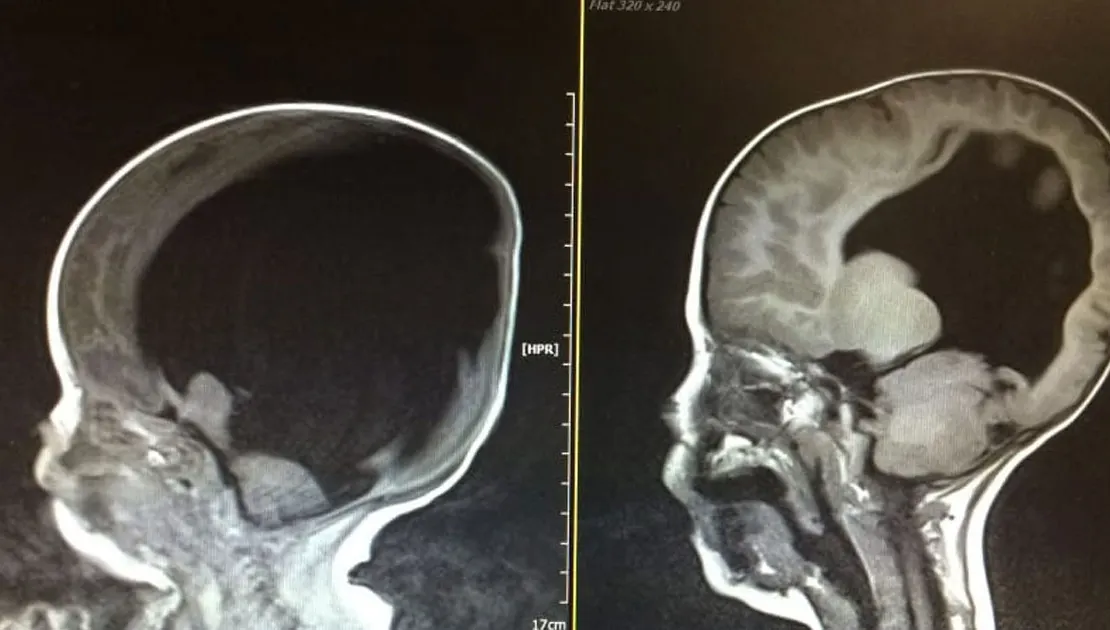 Medicul a sfătuit-o să întrerupă sarcina. Mama a spus: "Nu pot face asta". Ce a urmat, şocant!