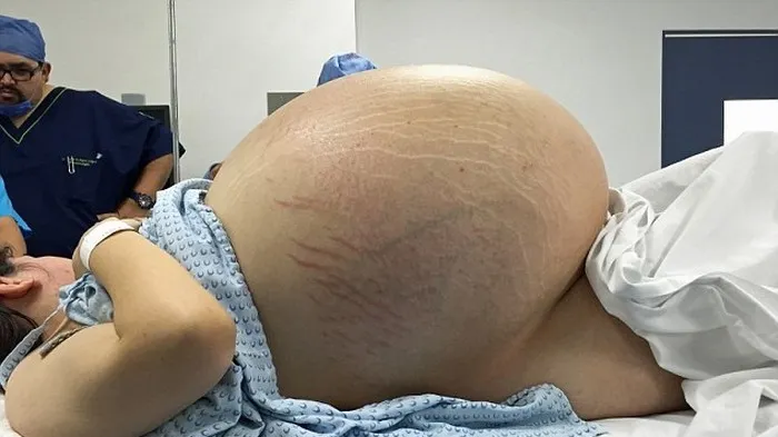 Când a ajuns la spital, medicii au zis că e însărcinată. Fata a negat. Ce i-au găsit în burtă..ȘOC