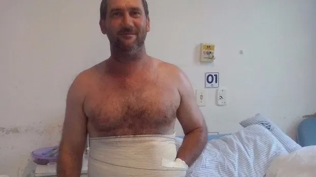 A suferit un accident teribil. Ce decizie uluitoare a luat medicul pentru a-i salva braţul mutilat