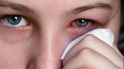 Ce înseamnă, de fapt, dacă simți că ți-a intrat ceva în ochi. Boala de care poți suferi