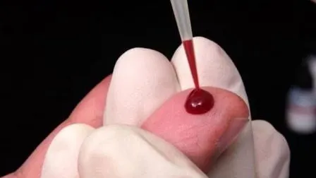 Singura ţară din America Latină care vinde în farmacii teste pentru depistarea HIV