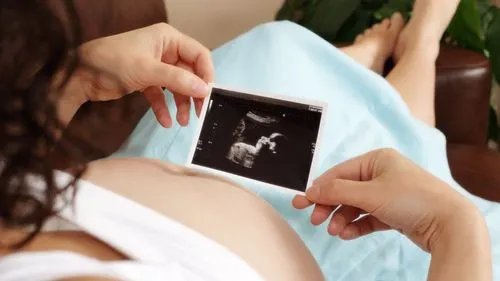 Ecografii în sarcină. Unde le poţi face gratuit şi de ce acte ai nevoie