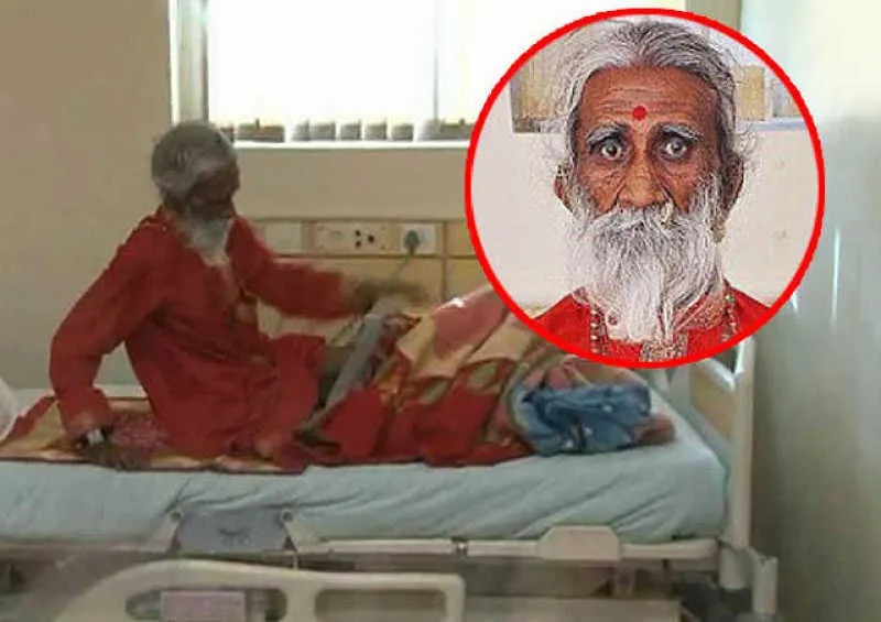 Cum arată bărbatul care n-a mai mâncat de 77 de ani. Doctorii sunt şocaţi!
