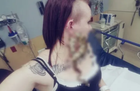A mers la spital cu cea mai ciudată urgenţă. Doctorii, uimiţi când au văzut ce avea în ureche