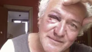 Ziarist român, SNOPIT în bătaie în Belgia! Au încercat să-l jefuiască