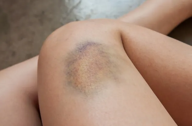 Simptome ale cancerului pe care femeile le ignoră cel mai des