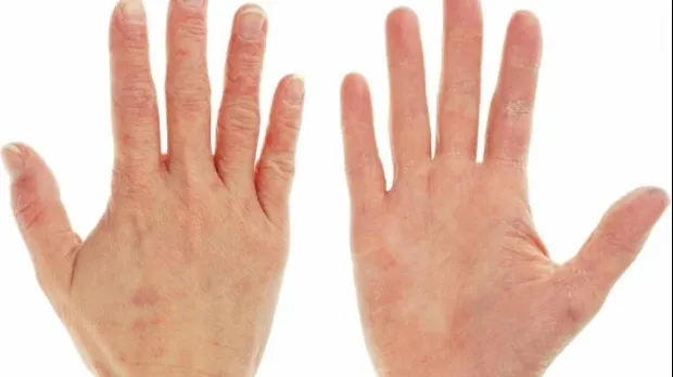 Semnele care trădează LIPSA vitaminelor din organism. Soluţia naturală pentru fiecare dintre ele!