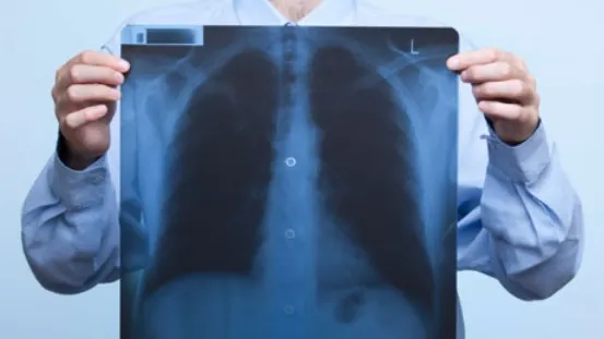 Motivul incredibil pentru care toţi fumătorii TREBUIE să consume mere şi roşii