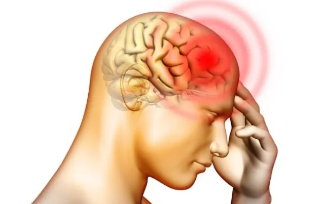 Persoanele care au migrene, de 8 ori mai predispuse la infarct. Concluziile alarmante ale medicilor