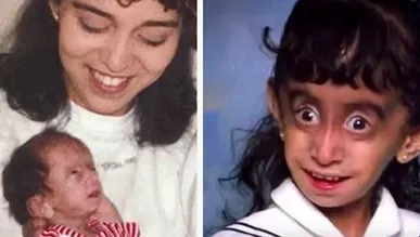 I-au spus că e un monstru care trebuie ucis cu foc! După 25 de ani, tânăra a şocat cu apariţia sa!