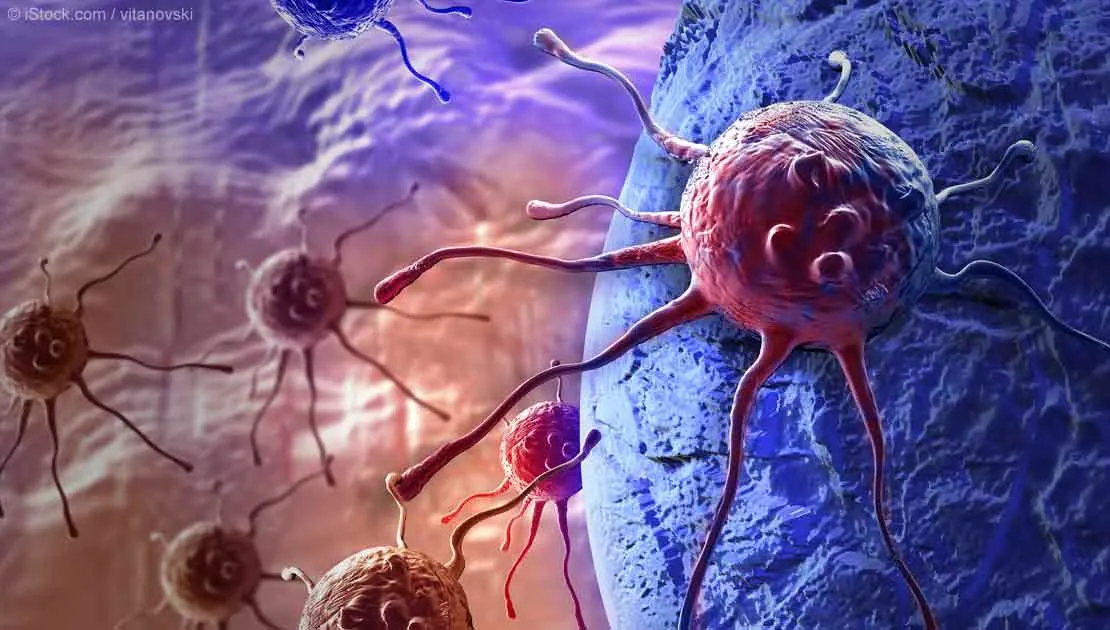Cancerul ascuns care poate trece neobservat luni de zile. Simptomul banal, ignorat de mulţi