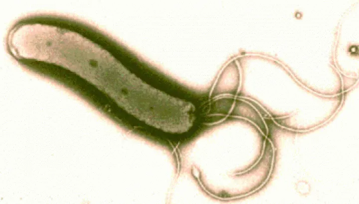 Leguma care omoară bacteria helicobacter pilori, cea care cauzează ulcerele