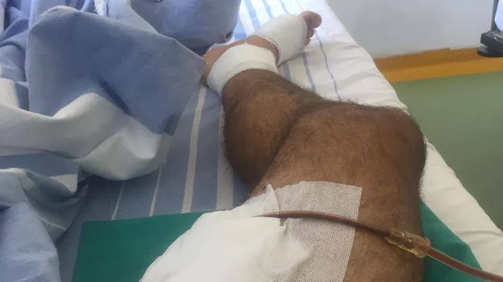 Un bărbat rănit de o grenadă a jandarmilor așteaptă Poliția și procurorii pe patul de spital