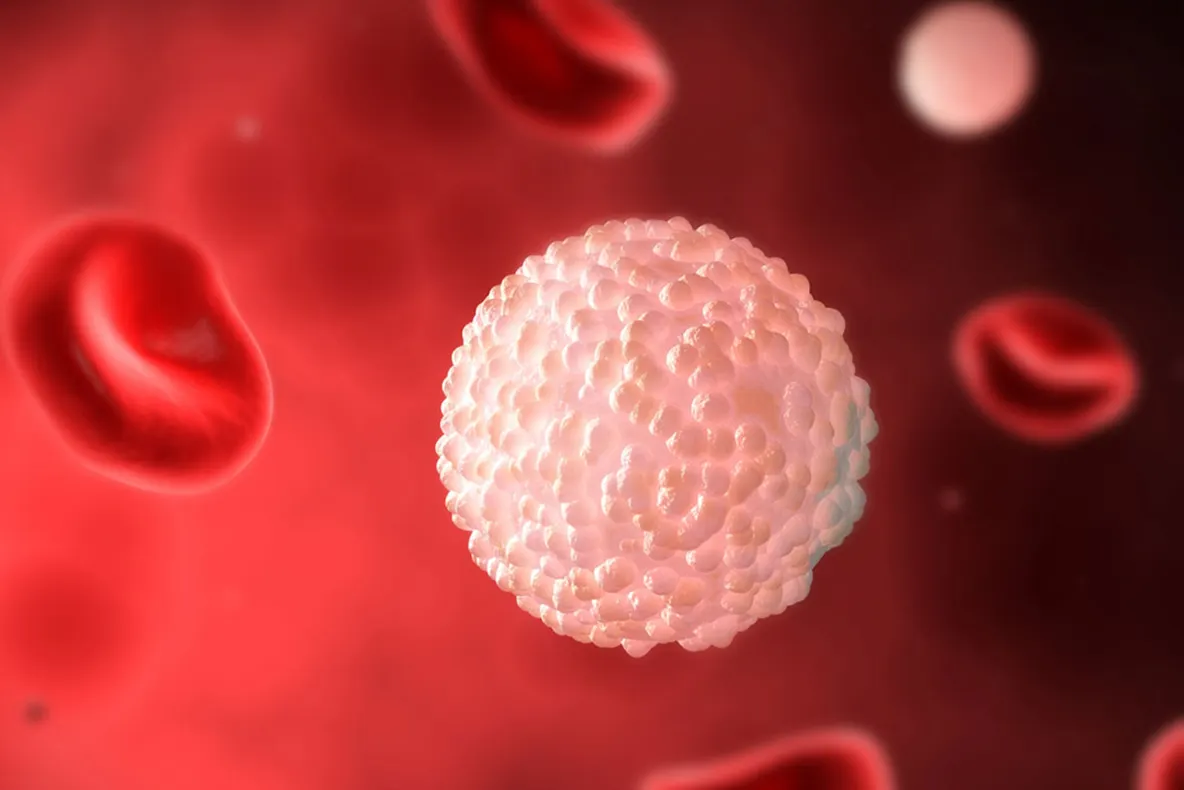 Ce este septicemia?