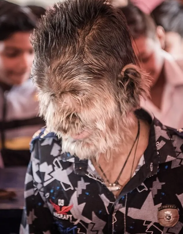 Copilul vârcolac șochează lumea. Părinții și-au dorit un băiat, dar au avut 5 fete. Apoi...