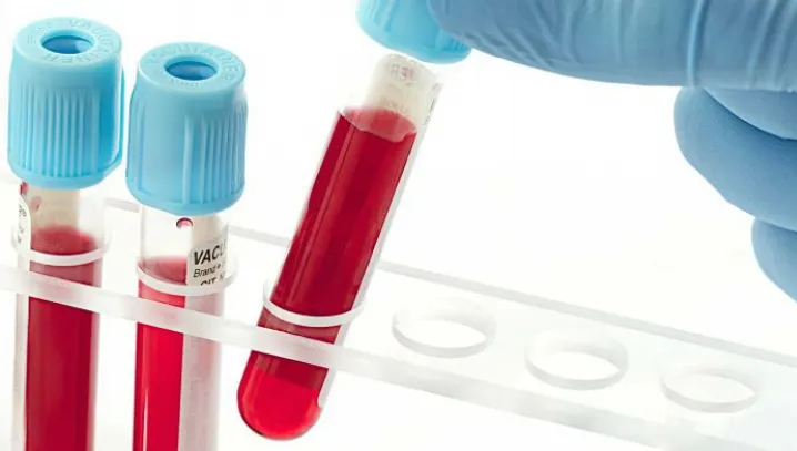 Un nou test de sânge ar putea REVOLUȚIONA diagnosticul de cancer