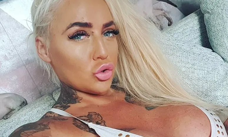 Actriţa porno Bambi Black şi-a injectat acid hialuronic în buze, se zbate între viaţă şi moarte