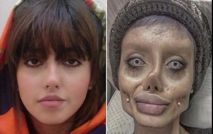 Tânăra "zombie" care vroia să devină Angelina Jolie, mesaj tulburător din închisoarea din Iran