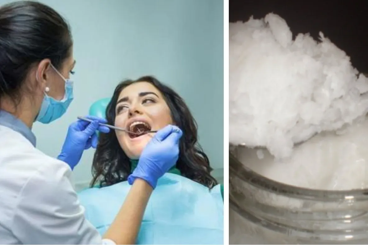 Cum scapi de carii în cel mai scurt timp. Descoperirea uimitoare care te fereşte de dentist