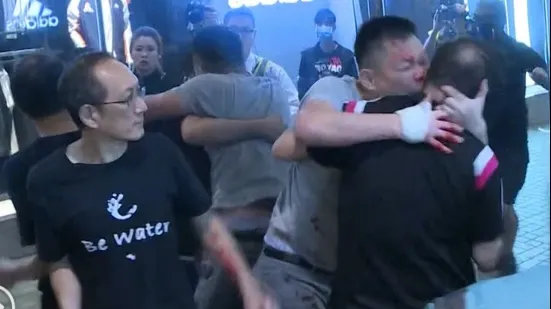 Haos în Hong Kong. Un politician a rămas fără o ureche, fiind mușcat violent