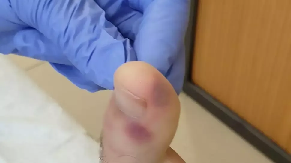 Uita-te atent la picioare, ai putea afla din timp dacă ai COVID