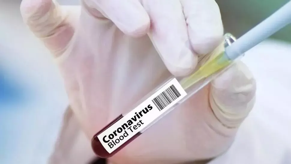 Bilanțul deceselor în România, actualizat: 94 de persoane infectate cu coronavirus au murit