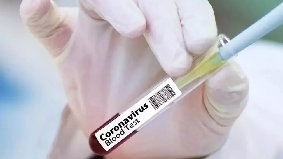 Coronavirus în România, bilanț oficial. SUTE de noi cazuri anunțate de autorități. Câți români s-au vindecat