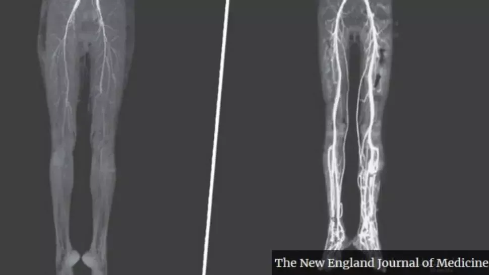 S-a dus la doctor cu dureri și arsuri în picioare, dar a primit un diagnostic tulburător: "boala focului sfânt"