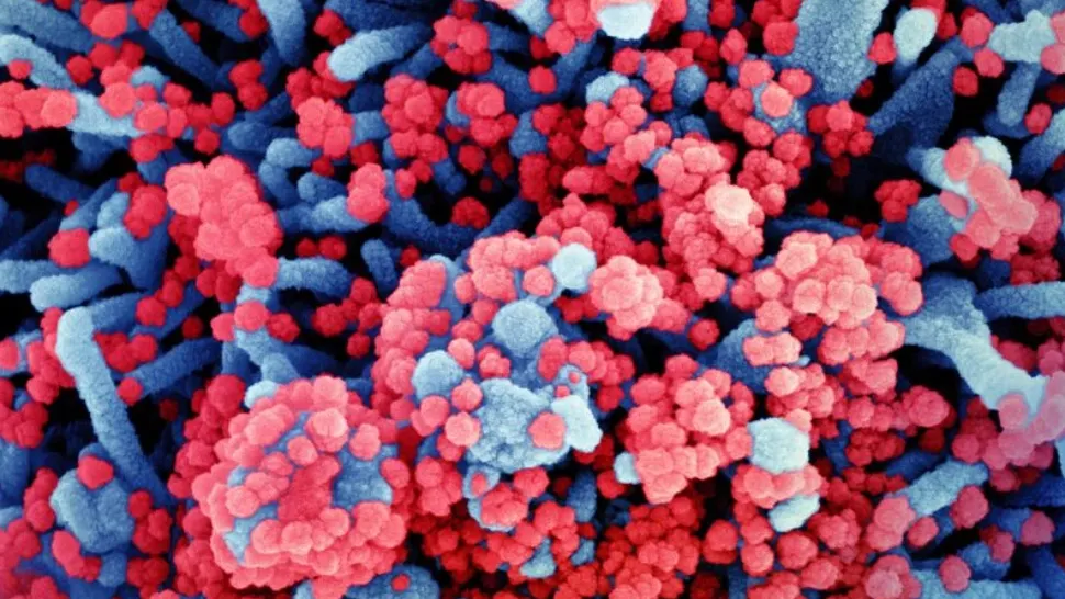 DE CE este coronavirusul atât de INFECȚIOS: are o abilitate extraordinară - se multiplică în glandele salivare, folosite ca adevărate rezervoare - STUDIU