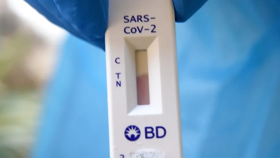 România trimite 100.000 de teste rapide antigen COVID-19 în Republica Moldova