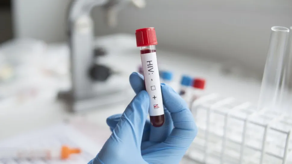 Caz medical extrem de rar: O femeie s-a vindecat de HIV fără tratament