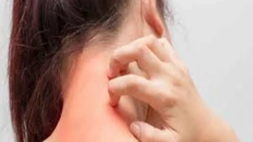 Alergia la latex - simptomele care trebuie să te trimită la medic