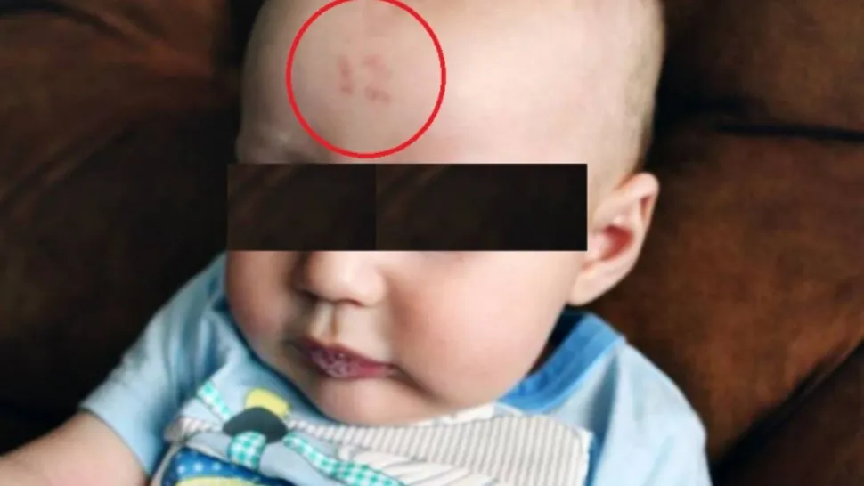 Medicii, uimiţi de semnul care i-a apărut unui bebeluş pe frunte, după naştere FOTO
