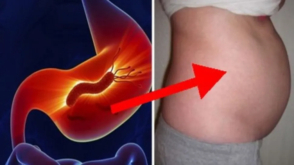 Bacteria care distruge stomacul. Și tu o poți avea fără să-ți dai seama