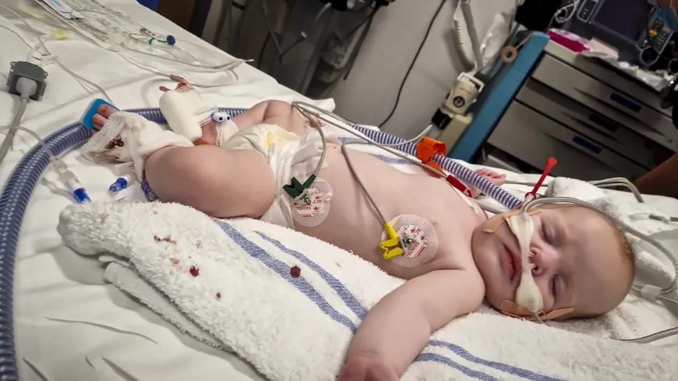 Bebeluș de 5 luni, infectat cu FLURONA (gripa + COVID) na la Iași. Medicii sunt în alertă