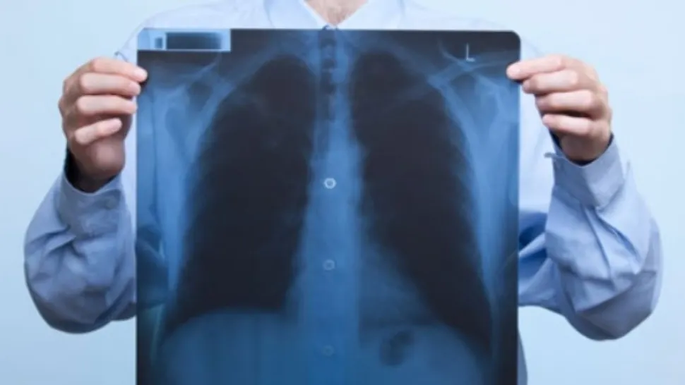 Cântăreț român, diagnosticat cu cancer la plămâni - anunțul care a cutremurat fanii 
