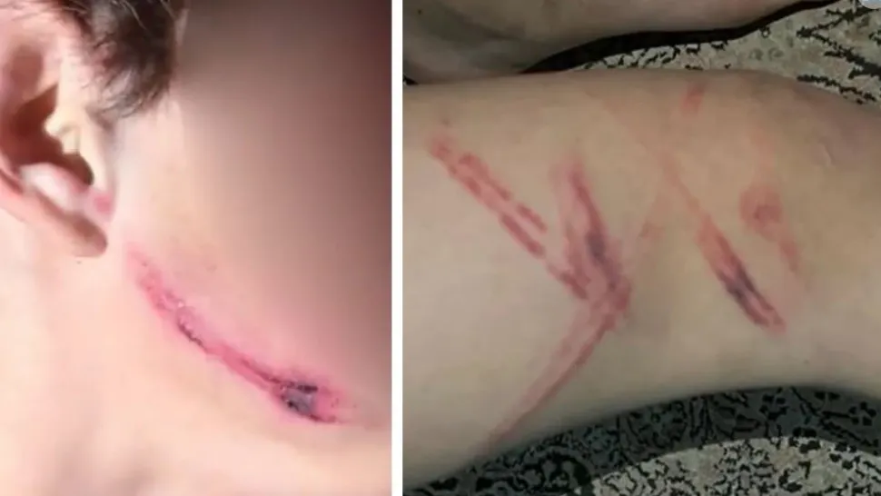 Caz șocant în județul Brașov. Doi copii au fost bătuți de ciobanii beți de la o fermă
