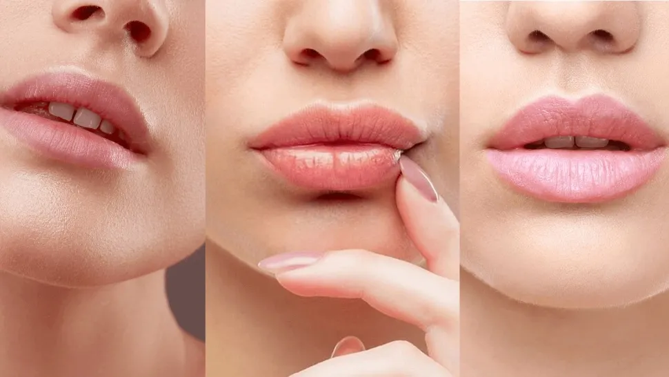 Un salon în care se făceau proceduri cosmetice de augmentare a buzelor, AMENDAT CU 40.000 lei